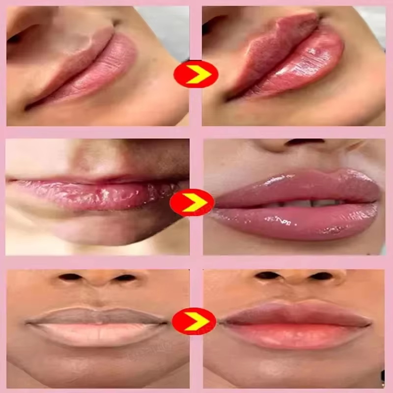 زيت تكبير الشفاه الفوري، ملمع  - مراجعة Lip Gloss Plumping وسعره