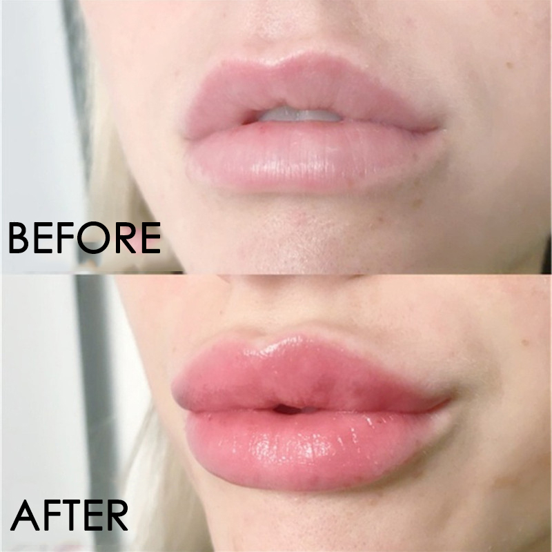 مصل العناية بالشفاه تكثيف فوري - مراجعة Lip Gloss Plumping وسعره